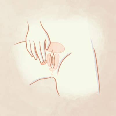 Disegno applicazione Meclon Lenex