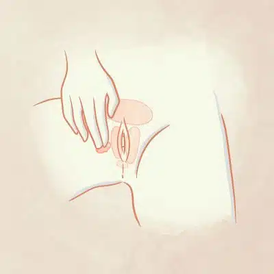 Disegno applicazione Meclon Lenex