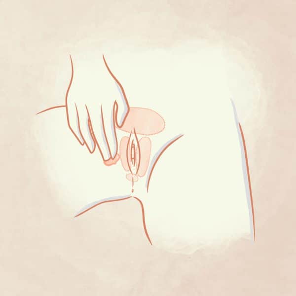 Disegno applicazione Meclon Lenex