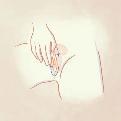 Disegno massaggio cute vulvare con Meclon Lenex