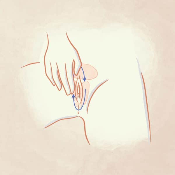 Disegno massaggio cute vulvare con Meclon Lenex