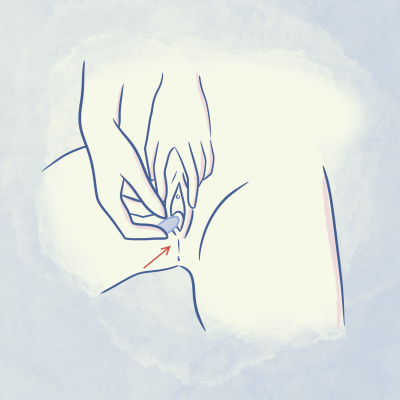 inserisci l’ovulo in profondità