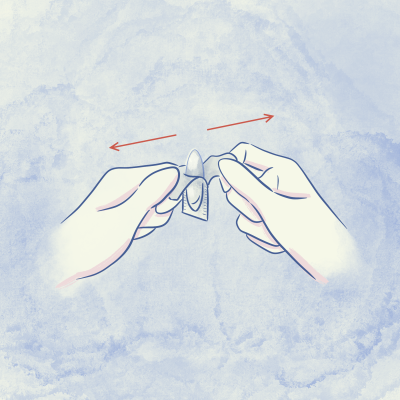 Rimuovi l’ovulo dalla confezione protettiva