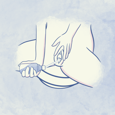 inserisci la cannula in vagina, delicatamente in profondità